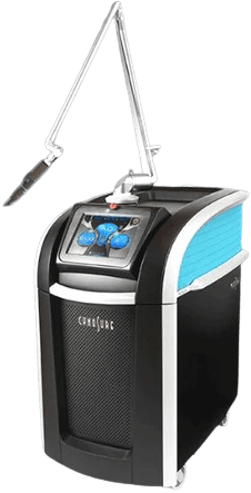 Pico Laser Treatment