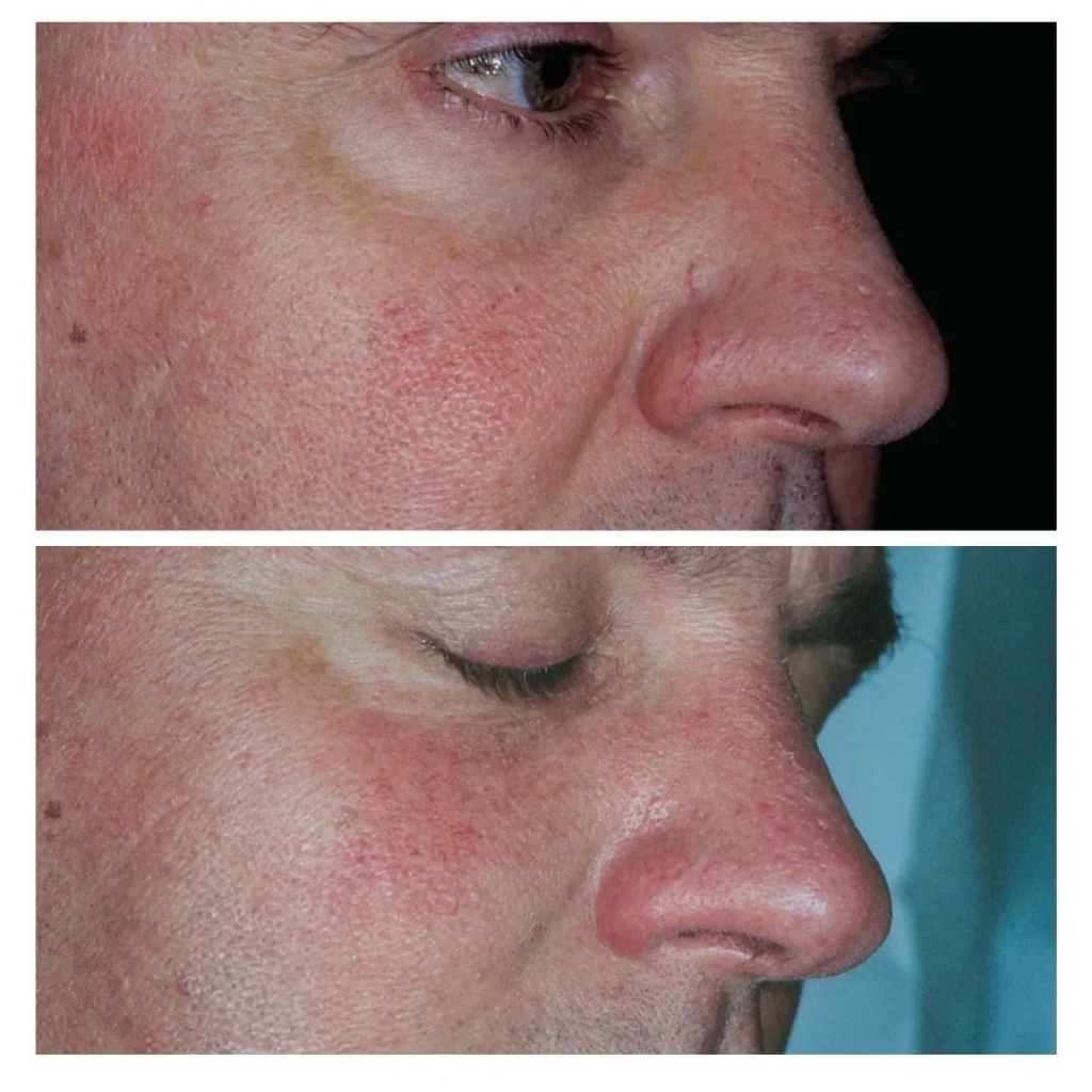 Face Man2