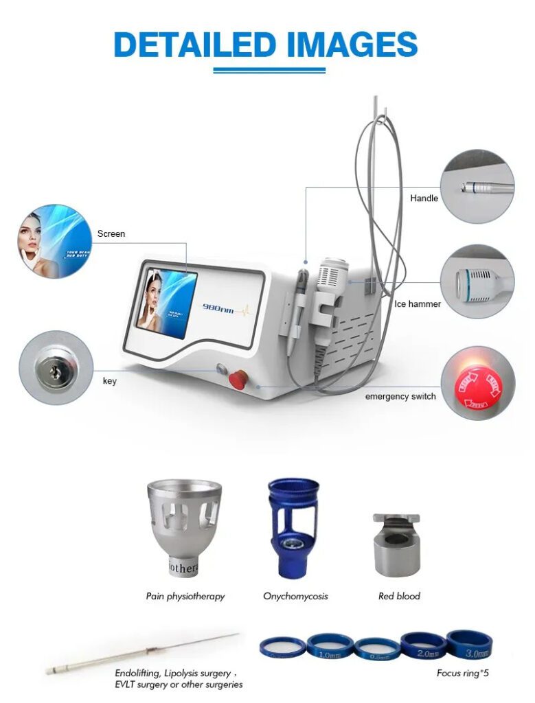 Laser Vein Removal