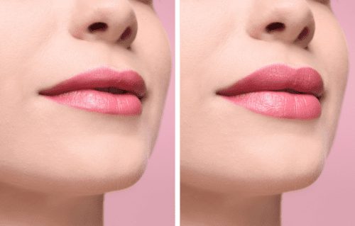 Lipsweb