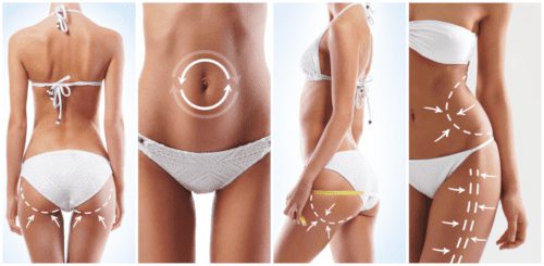 body contouring
