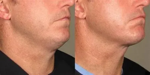 man neck web