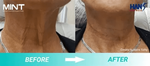 mint neck
