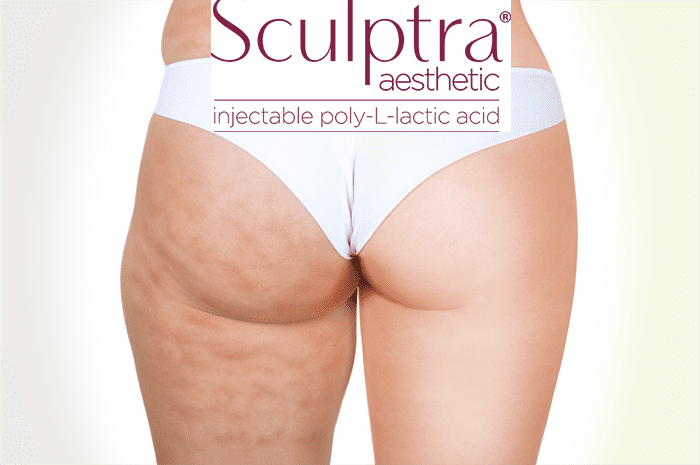 sculptra butt