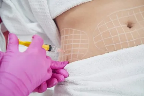 Body Contouring