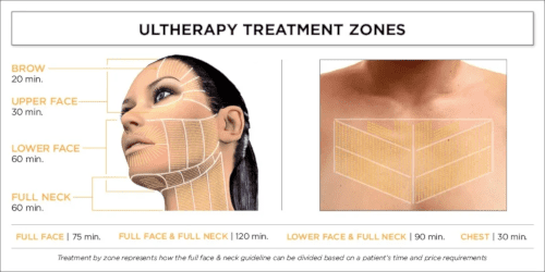 ultherapy