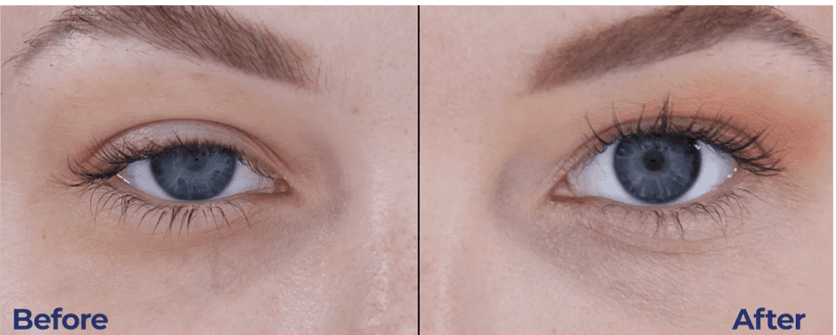 Results of before and after