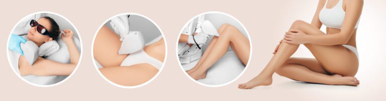 Hair Removal