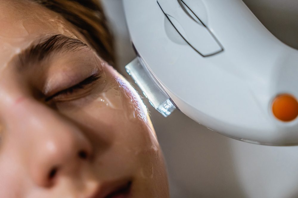 ipl for dry eyes