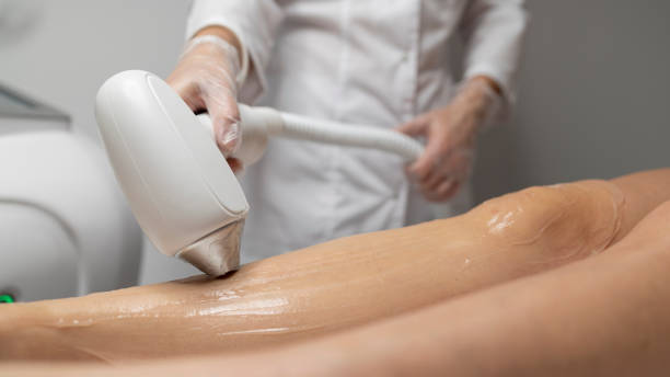 Body contouring non invasive