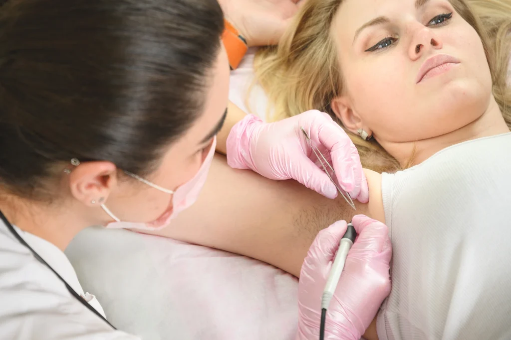 Electrolysis hair removal