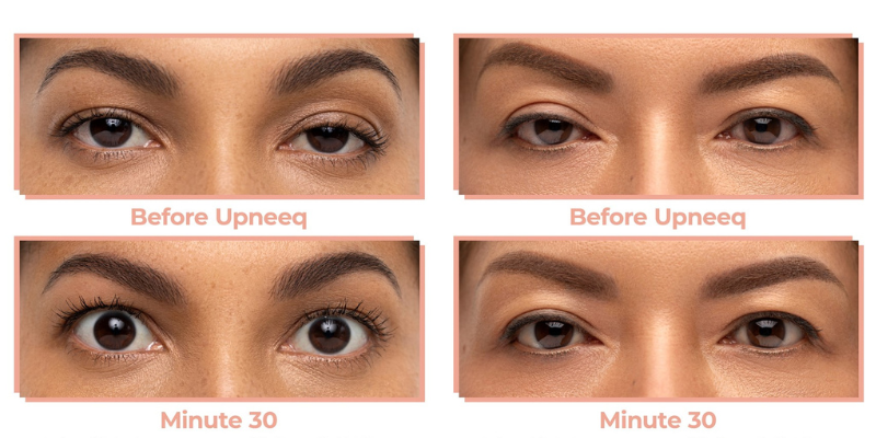How does upneeq work