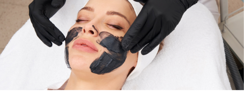 Carbon laser facial