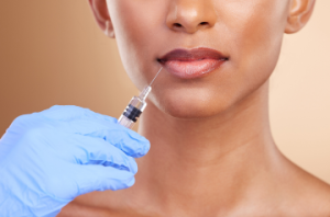 Lip filler