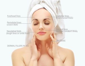 Facelift Procedure Steps