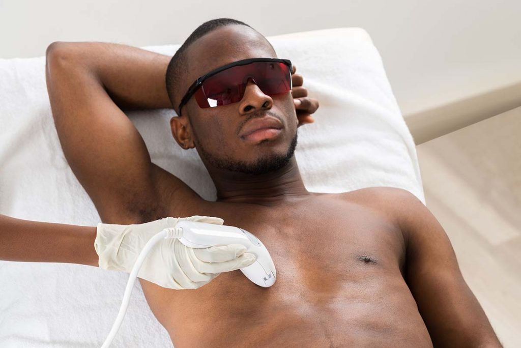 Laser Hair Removal For Dark Skin