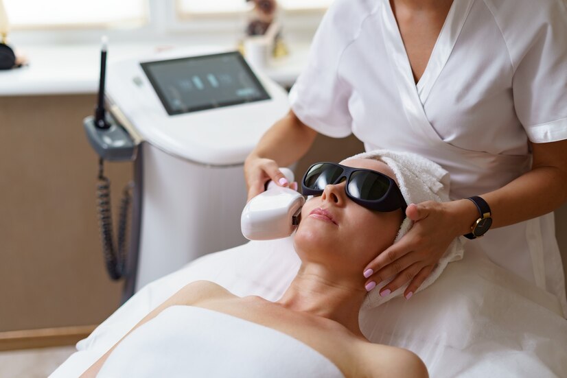 Pico Laser Treatment
