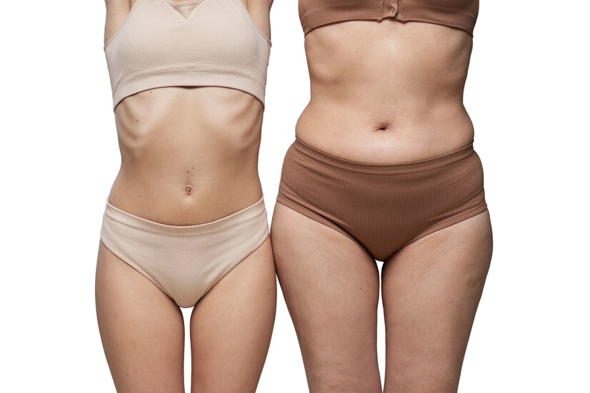 Tummy Tuck Before And After