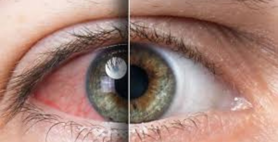 Brilliant Eye Care