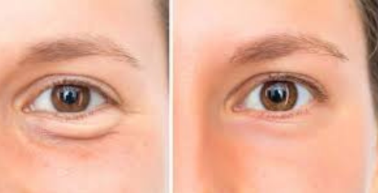 Brilliant Eye Care