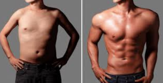 Body Contouring New York