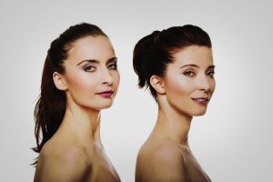 Mini Facelifts before and after