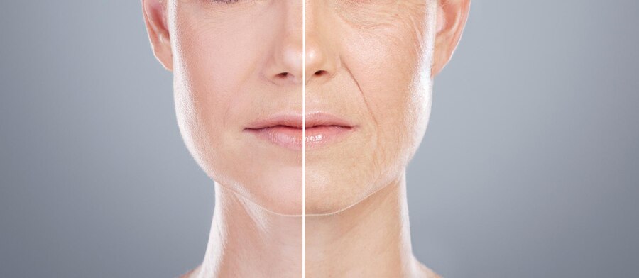 Before And After PDO Threads