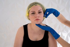 Facelift Without Surgery