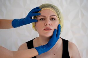 Facelift Without Operation