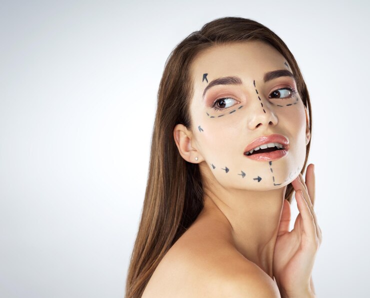 Facelifts are kind of great now