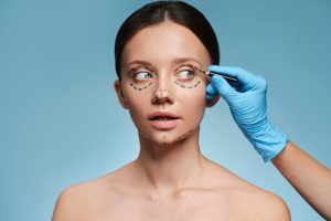 Facelifters