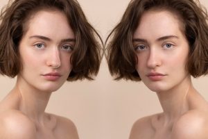Jawline PDO Threads Before And After