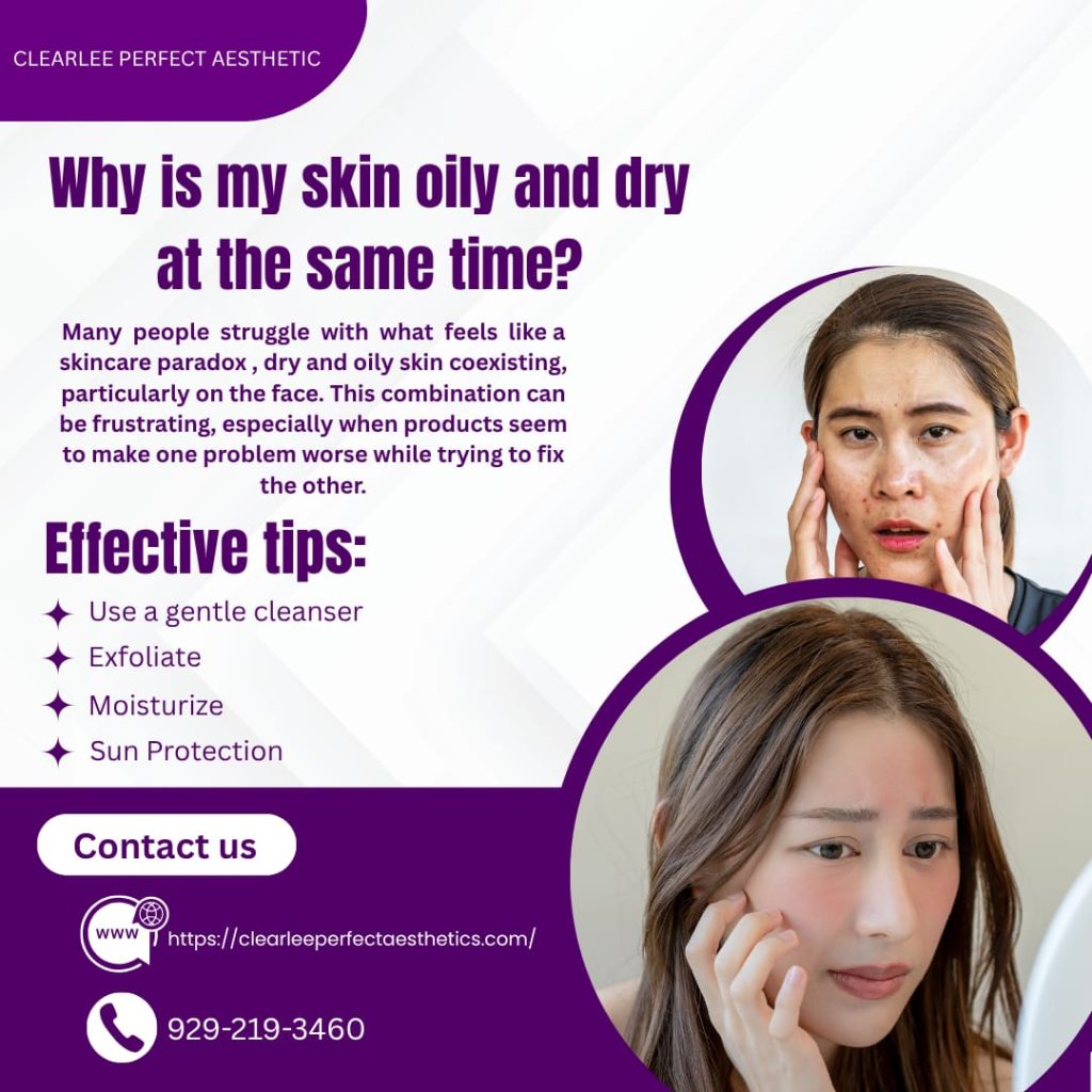 Dry and Oily Skin Explained Why Your Face Feels Confused?