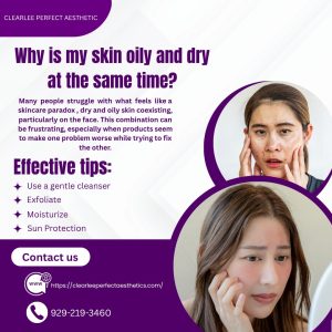 Dry and Oily Skin Explained Why Your Face Feels Confused?