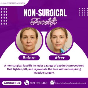 Non-Surgical Facelifts Comparing Options and Outcomes