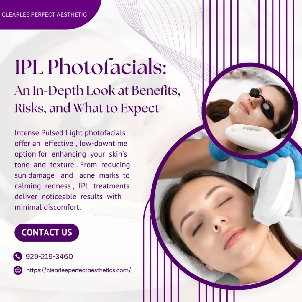 IPL Photofacials: An In-Depth Look at Benefits, Risks, and What to Expect