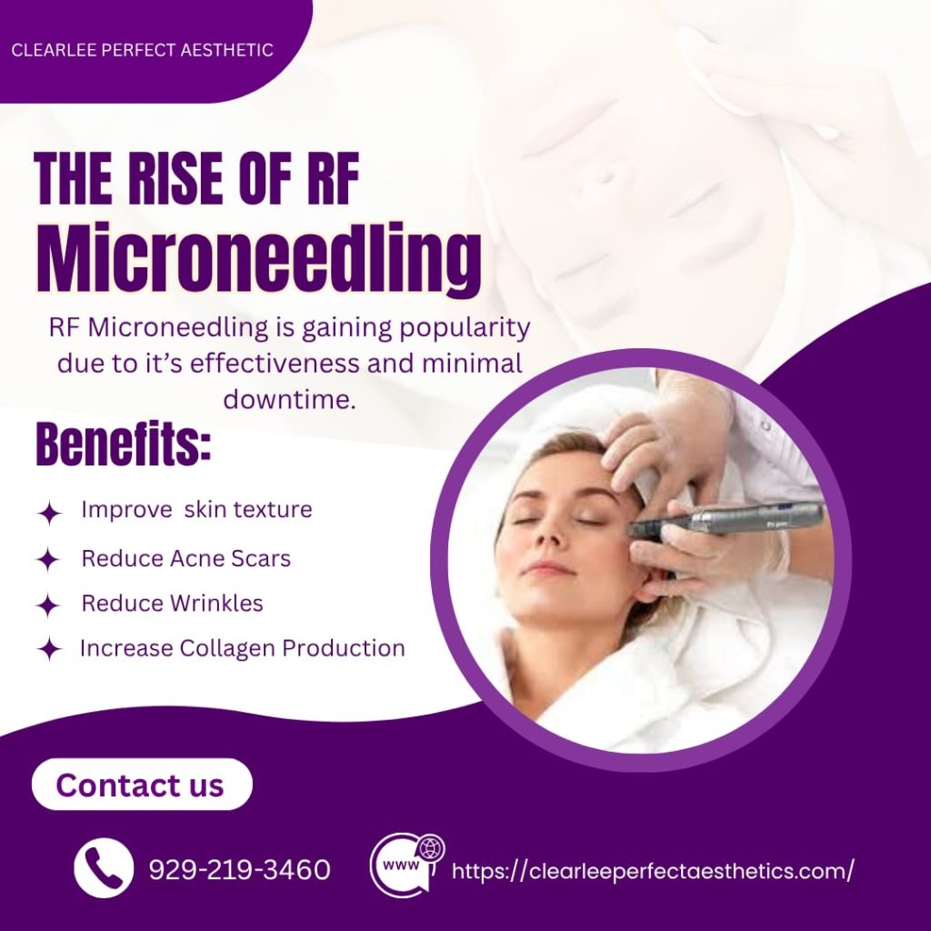 The Rise Of RF Microneedling