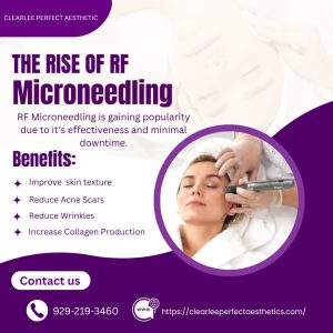 The Rise Of RF Microneedling