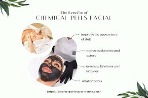Chemical Peel