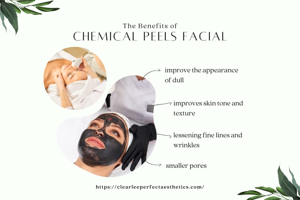 Chemical Peel