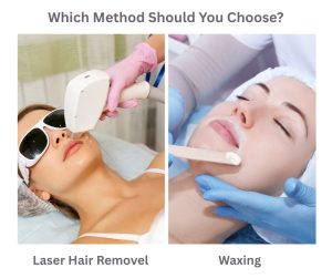 Laser Hair Removal Vs Waxing