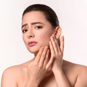 Uneven Skin Texture